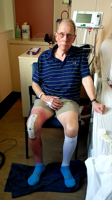 , Moto; Une mise à jour rapide